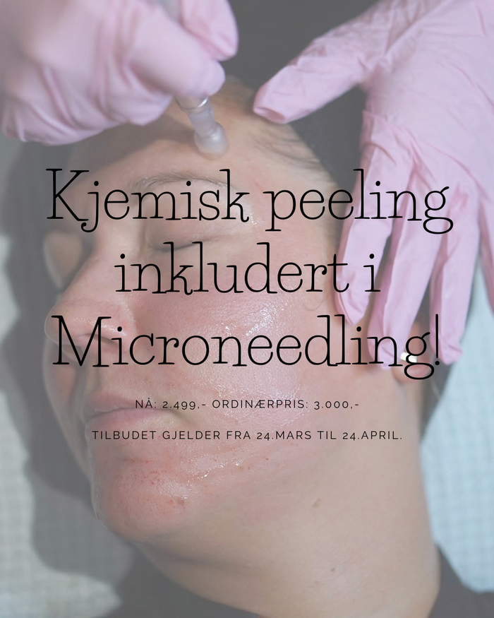 Microneedling